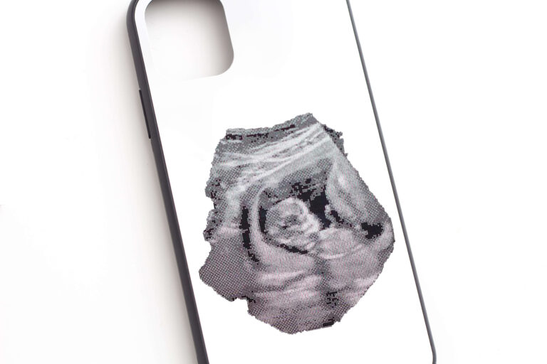 Baby Ultrasound Phone Case